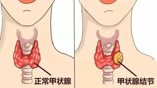 娱乐生活